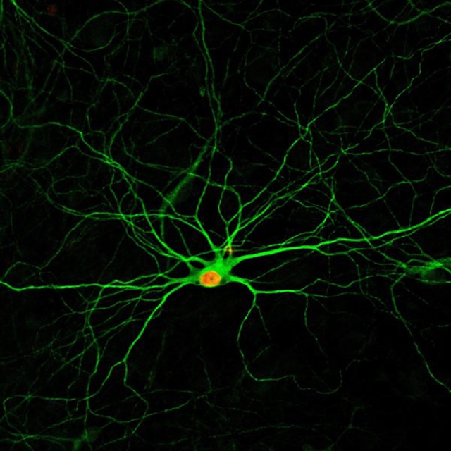 «Χάπι» θα αναγεννά νευρώνες στον εγκέφαλο. Ελπίδα για ασθενείς με Αλτσχάιμερ, εγκεφαλικό - Φωτογραφία 1
