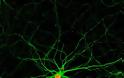 «Χάπι» θα αναγεννά νευρώνες στον εγκέφαλο. Ελπίδα για ασθενείς με Αλτσχάιμερ, εγκεφαλικό
