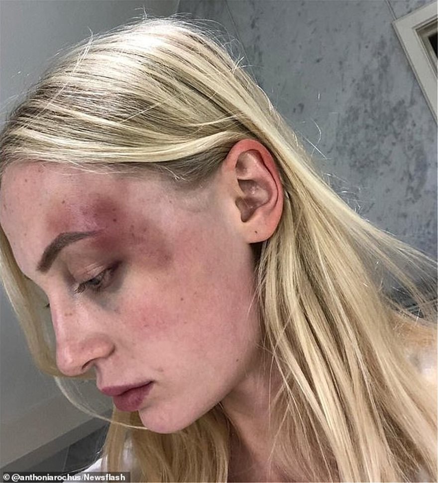 Βέλγιο: Σοκάρει το «ημερολόγιο κακοποίησης» 21χρονου μοντέλου -  φωτος - Φωτογραφία 4