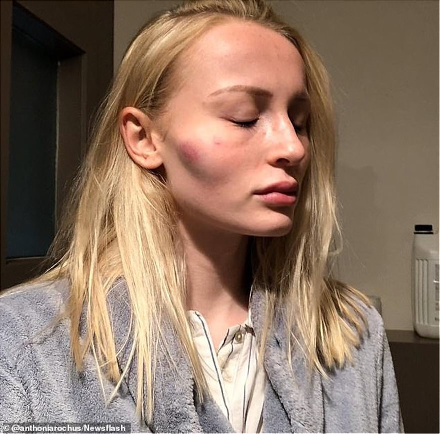 Βέλγιο: Σοκάρει το «ημερολόγιο κακοποίησης» 21χρονου μοντέλου -  φωτος - Φωτογραφία 6