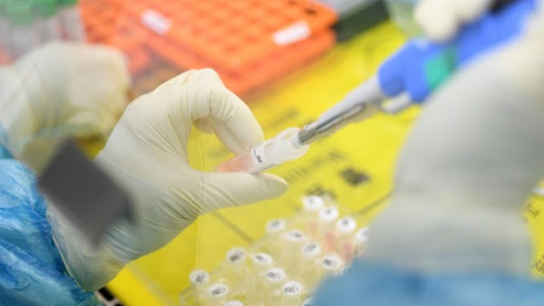 Ανιχνεύει τον κοροναϊό σε μόλις 5 λεπτά, χάρη στη γονιδιακή τεχνική CRISPR που πήρε Νόμπελ Χημείας - Φωτογραφία 1