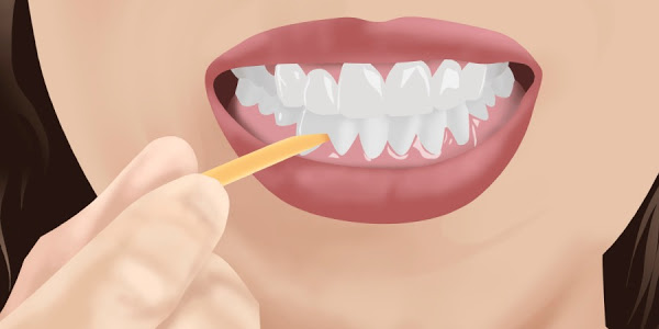 Είναι καλό να καθαρίζουμε τα δόντια μας, με οδοντογλυφίδες; - Φωτογραφία 1