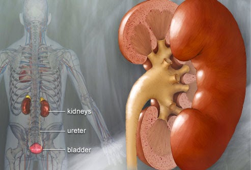 Πόνος στη μέση από τα νεφρά; Πέτρα στους νεφρούς, νεφρολιθίαση, οξεία νεφρική ανεπάρκεια - Φωτογραφία 3
