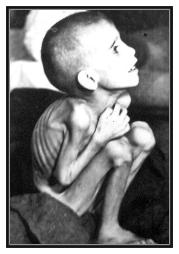 Βαθύτερες αιτίες που επέτειναν την πείνα, τον λιμό στα χρόνια της Κατοχής, το 1940 - Φωτογραφία 4