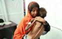 Υεμένη: Σχεδόν 50.000 άνθρωποι κινδυνεύουν να λιμοκτονήσουν το 2021
