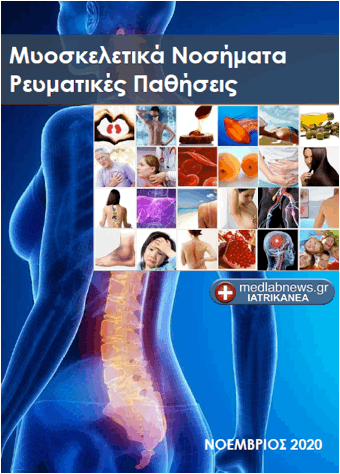 Νέο δωρεάν ηλεκτρονικό βιβλίο: Μυοσκελετικά Νοσήματα – Ρευματικές παθήσεις - Φωτογραφία 1