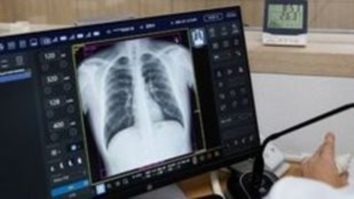 Οι συνέπειες της COVID-19 στους πνεύμονες και σε άλλα όργανα του σώματος που οδηγούν στον θάνατο - Φωτογραφία 1