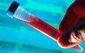 Απλή εξέταση αίματος εντοπίζει δεκάδες τύπους καρκίνου-Blood test for cancer