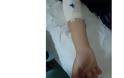 Εύοσμος: Άγριος ξυλοδαρμός 15χρονου - Νοσηλεύεται με κρανιοεγκεφαλικές κακώσεις