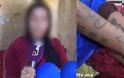 Μαρόκο: 11 άντρες αγόρασαν 17χρονη - Tην έκαιγαν με τσιγάρα και της χάραζαν τατουάζ στο σώμα