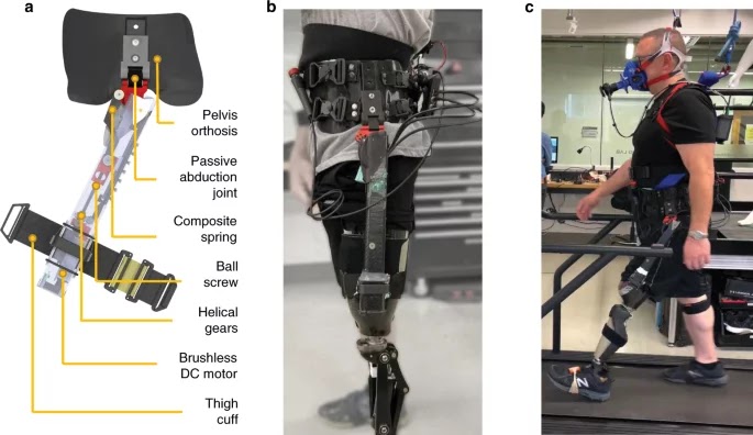 Ένας νέος «έξυπνος» εξωσκελετός βελτιώνει σημαντικά τη βάδιση των ασθενών με ακρωτηριασμό πάνω από το γόνατο - Φωτογραφία 1