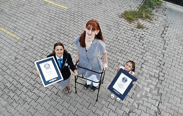 Η πιο ψηλή γυναίκα του κόσμου είναι από την Τουρκία - Φωτογραφία 1