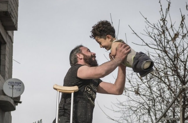 Συγκλονίζει η φωτογραφία της χρονιάς: Ο ακρωτηριασμένος πατέρας και το παιδί του - Φωτογραφία 1