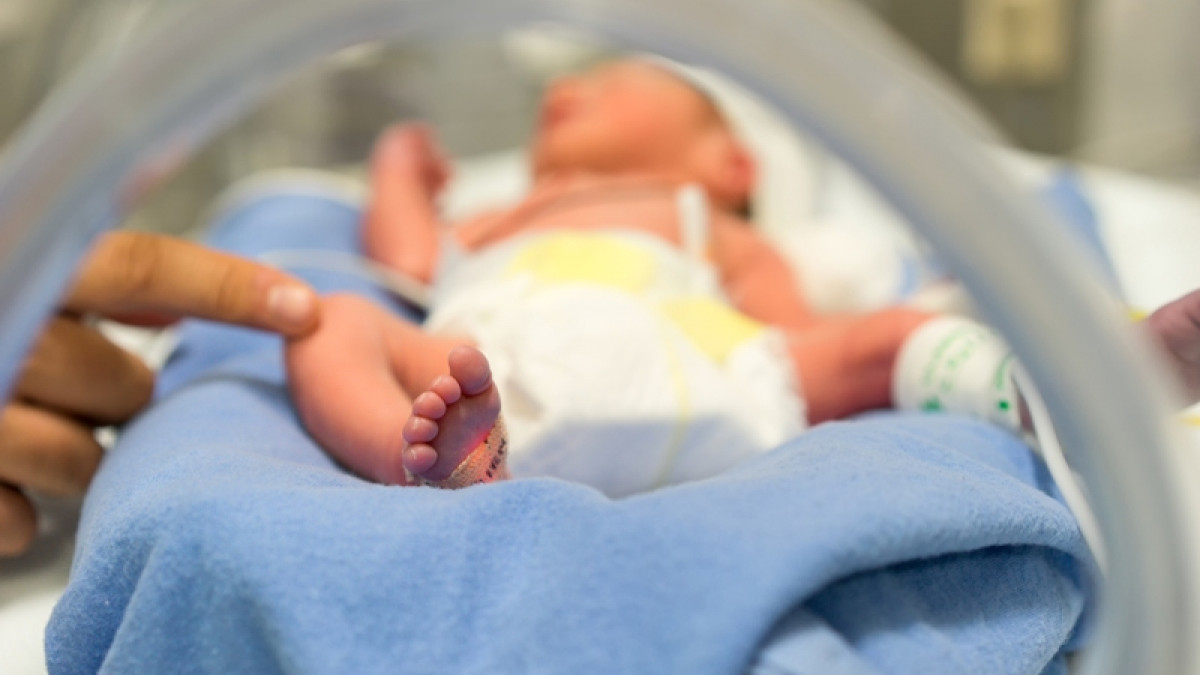 Βραζιλία: Μωρό γεννήθηκε με ουρά 12 εκατοστών - Φωτογραφία 1
