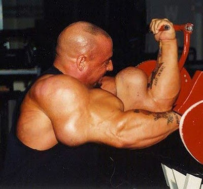 Ακόμα ένα θύμα του bodybuilding που χρησιμοποίησε την ουσία synthol - Φωτογραφία 3