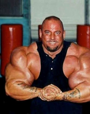 Ακόμα ένα θύμα του bodybuilding που χρησιμοποίησε την ουσία synthol - Φωτογραφία 4