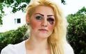 Νεαρή γυναίκα ξυλοκοπήθηκε στον αγώνα Ελλάδας-Γερμανίας επειδή ως Γερμανοελληνίδα τόλμησε να υποστηρίξει (και) την Ελλάδα