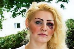 Έφαγε ξύλο επειδή πανηγύρισε το γκολ της Ελλάδας