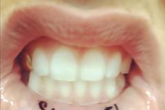 QUIZ: Ποια γνωστή τραγουδίστρια χτύπησε tattoo... στα χείλη;