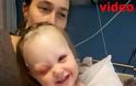 VIDEO: 2χρονη σώθηκε από θαύμα - Μολύβι καρφώθηκε στο μάτι της