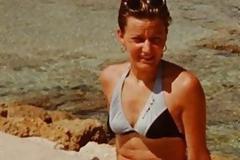 Τη «σκότωσαν» τα εμφυτεύματα στήθους