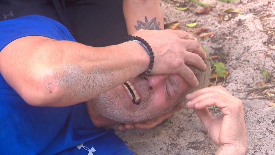 Survivor: Κόντεψε να του βγει το μάτι μετά από τσίμπημα σφήκας... - Φωτογραφία 1