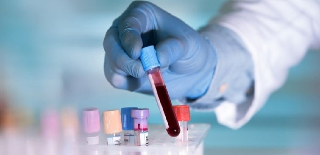 Νέο τεστ αίματος ανιχνεύει τον καρκίνο σε ανθρώπους που δεν έχουν συγκεκριμένα συμπτώματα - Φωτογραφία 1