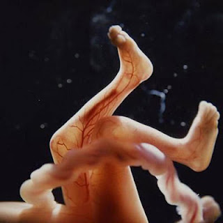 Η διαδικασία γονιμοποίησης & εγκυμοσύνης σε συγκλονιστικές macro φωτογραφίες - Φωτογραφία 1