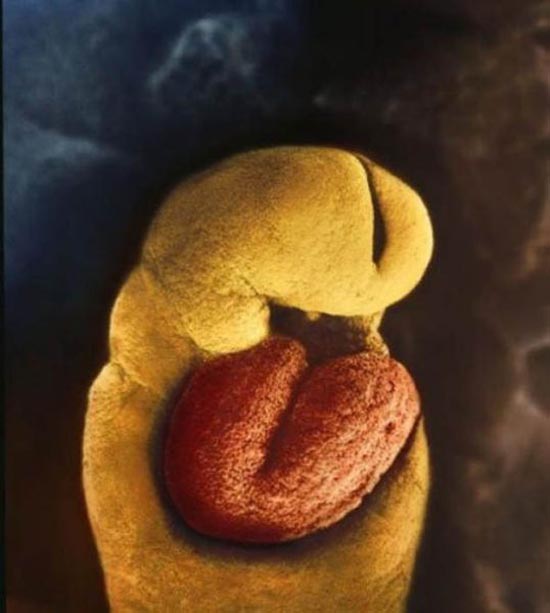 Η διαδικασία γονιμοποίησης & εγκυμοσύνης σε συγκλονιστικές macro φωτογραφίες - Φωτογραφία 12