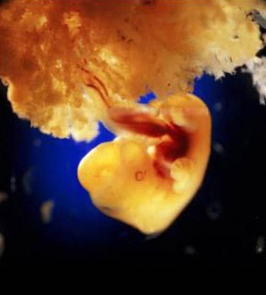 Η διαδικασία γονιμοποίησης & εγκυμοσύνης σε συγκλονιστικές macro φωτογραφίες - Φωτογραφία 16