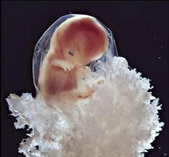 Η διαδικασία γονιμοποίησης & εγκυμοσύνης σε συγκλονιστικές macro φωτογραφίες - Φωτογραφία 18