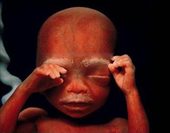 Η διαδικασία γονιμοποίησης & εγκυμοσύνης σε συγκλονιστικές macro φωτογραφίες - Φωτογραφία 26