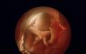 Η διαδικασία γονιμοποίησης & εγκυμοσύνης σε συγκλονιστικές macro φωτογραφίες - Φωτογραφία 27