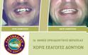 Ίσια δόντια με το σύστημα Fastbraces - Φωτογραφία 8