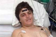 ΔΕΙΤΕ: Αλιγάτορας τού έκοψε το χέρι!