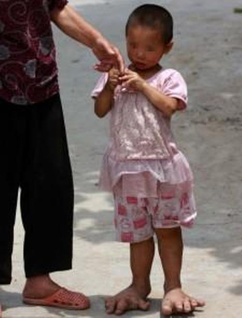 Συγκλονιστική εικόνα: Κοριτσάκι χόμπιτ στην Κίνα - Φωτογραφία 2