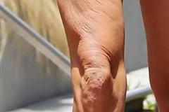 Αυτά τα πόδια κάποτε «τράνταζαν» τις πασαρέλες