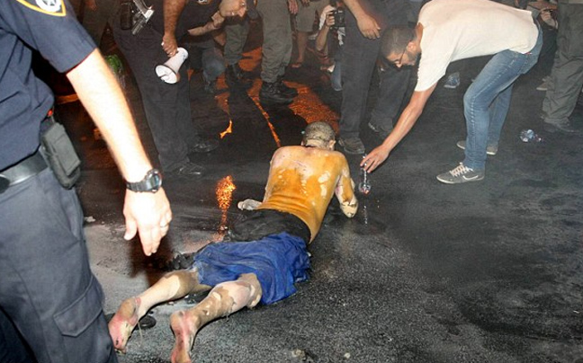 ΔΕΙΤΕ: Σοκαριστικές φωτογραφίες διαδηλωτή που αυτοπυρπολήθηκε στο Ισραήλ - Φωτογραφία 5