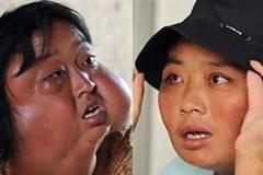 Οι γιατροί της χάρισαν νέο πρόσωπο