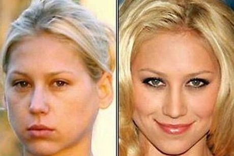 ΔΕΙΤΕ: Celebrities χωρίς make up!!! - Φωτογραφία 10