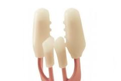 Σε τι χρησιμεύει αυτό το παράξενο gadget;