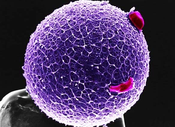 ΕΚΠΛΗΚΤΙΚΕΣ ΦΩΤΟ: Δείτε το ανθρώπινο σώμα στο… μικροσκόπιο! - Φωτογραφία 10