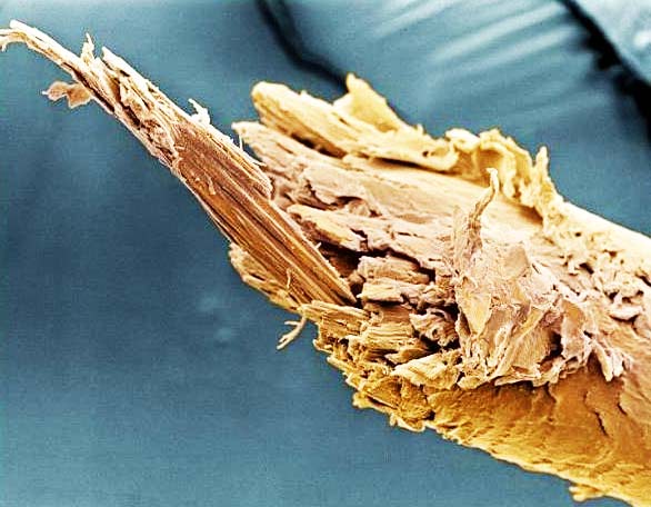 ΕΚΠΛΗΚΤΙΚΕΣ ΦΩΤΟ: Δείτε το ανθρώπινο σώμα στο… μικροσκόπιο! - Φωτογραφία 4