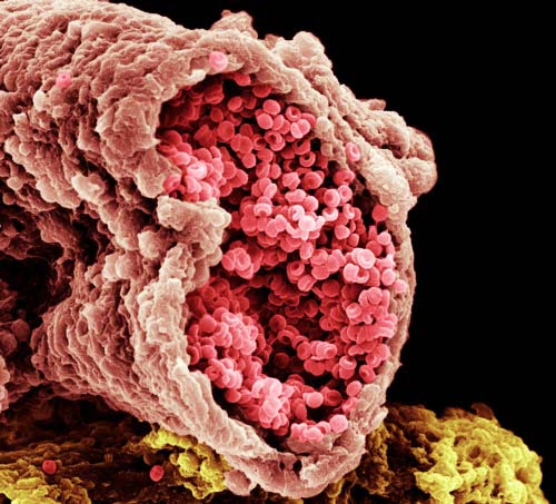 ΕΚΠΛΗΚΤΙΚΕΣ ΦΩΤΟ: Δείτε το ανθρώπινο σώμα στο… μικροσκόπιο! - Φωτογραφία 5