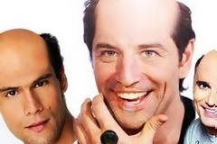 ΔΕΙΤΕ: Πως θα ήταν οι διάσημοι έλληνες καραφλοί!