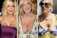 Τα χειρότερα ψεύτικα στήθη του Χόλιγουντ...