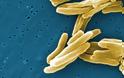 Πέντε παιδιά βρέθηκαν θετικά στη φυματίωση