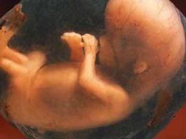 Βρέθηκαν 248 ανθρώπινα έμβρυα εγκαταλελειμμένα σε δάσος - Φωτογραφία 1