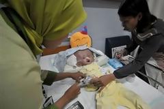 ΔΕΙΤΕ: Το κεφάλι της είναι τρεις φορές μεγαλύτερο από ενός ενήλικα