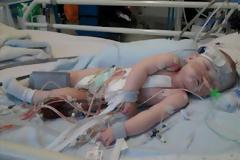 Εικόνα που ραγίζει καρδιές: Είναι 15 μηνών και χρειάζεται μόσχευμα για να ζήσει!